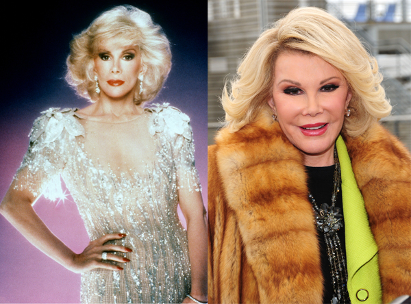 Comedienne Joan Rivers Is Dead 1